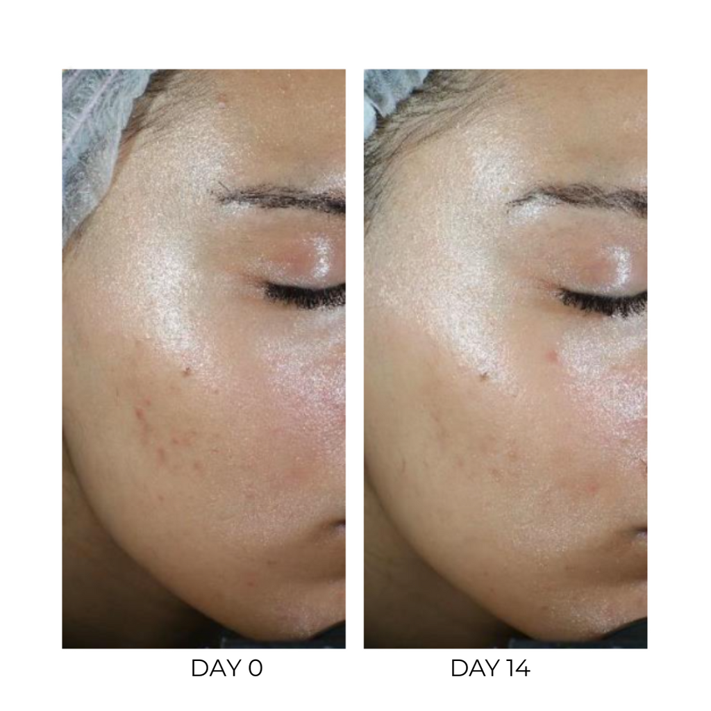 Renewing Retinoil Serum